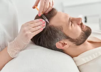 Saç Dökülmesi Tedavisi