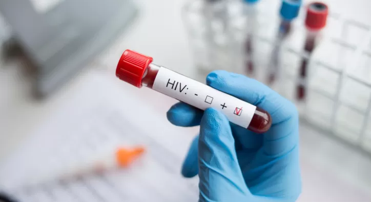 AIDS (HIV Virüsü) Hakkında