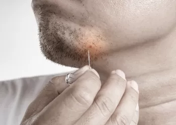 Kıl Dönmesi Nedir? Tıraş Olma Teknikleri Nelerdir?