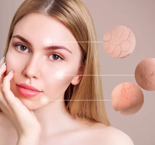 lumecca ışıltı lazeri