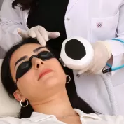 Dermatoloji Tedavi Fotograflari