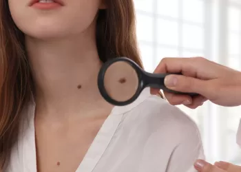 Et Beni Aldırma İşlemi ile İlgili Tüm Detaylar