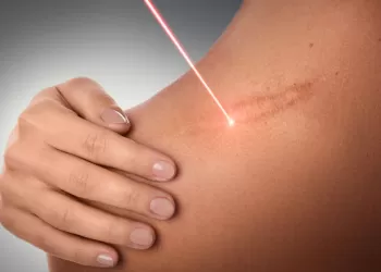 Fraksiyonel Lazer Nedir? Nasıl Uygulanır?