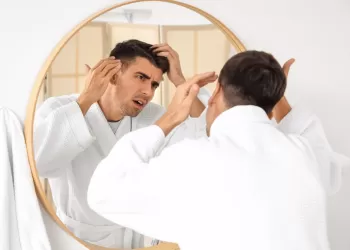 Saçkıran Hastalığı Neden Olur?