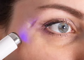 Yüzdeki Yara İzleri Nasıl Geçer?