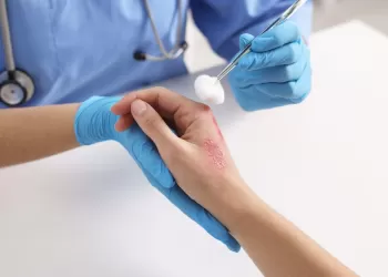 Cilt Hastalığı İhmal Edilmemeli!